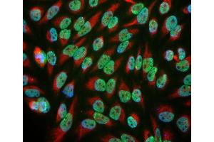 An image of HeLa cell cultures stained with antibody ABIN1842252 (green) and chicken antibody to vimentin CPCA-Vim (red). (EWSR1 抗体)