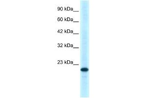 WB Suggested Anti-TNFRSF18 Antibody Titration:  0. (TNFRSF18 抗体  (C-Term))