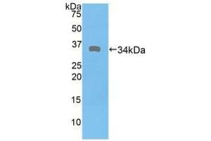 Western blot analysis of recombinant Human DMD. (Dystrophin 抗体  (AA 3048-3328))