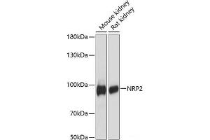 Western blot analysis of extracts of various cell lines using NRP2 Polyclonal Antibody at dilution of 1:3000. (NRP2 抗体)