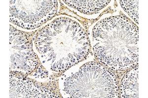 ABIN7096183 and ABIN7100245 at 1/100 staining rat testis tissue by IHC-P. (FAM181A 抗体)