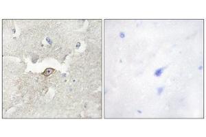 Immunohistochemistry (IHC) image for anti-Lemur tyrosine Kinase 2 (LMTK2) (Internal Region) antibody (ABIN1849762) (LMTK2 抗体  (Internal Region))
