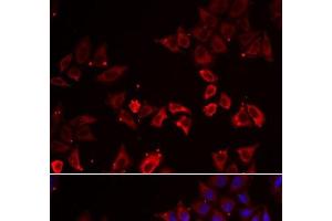 Immunofluorescence analysis of A549 cells using LIMS1 Polyclonal Antibody (LIMS1 抗体)