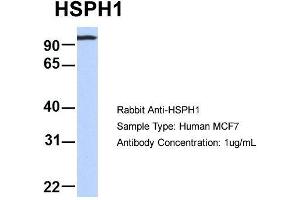 Host: Rabbit  Target Name: HSPH1  Sample Tissue: Human MCF7  Antibody Dilution: 1. (HSPH1 抗体  (Middle Region))