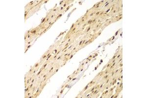 Immunohistochemistry of paraffin-embedded human colon using CDX1 antibody (ABIN2561793) at dilution of 1:100 (40x lens). (CDX1 抗体)