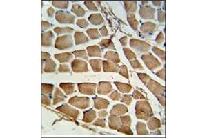 AP17920PU-N CARD4 antibody staining of Formalin-Fixed, Paraffin-Embedded Human skeletal muscle tissue.
