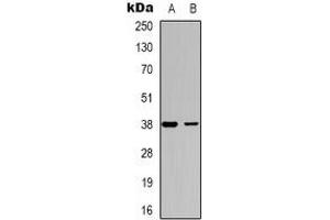 Western blot analysis of DOK6 expression in SHSY5Y (A), COLO205 (B) whole cell lysates.