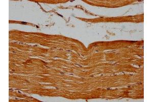 Immunohistochemistry (IHC) image for anti-Proteasome (Prosome, Macropain) Subunit, beta Type 2 (PSMB2) (AA 1-201) antibody (ABIN7164973)
