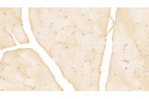 Detection of MSLN in Human Skeletal muscle Tissue using Monoclonal Antibody to Mesothelin (MSLN) (Mesothelin 抗体  (AA 296-606))
