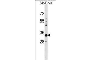 Western blot analysis in SK-BR-3 cell line lysates (35ug/lane). (PHYHD1 抗体  (C-Term))