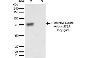 Western Blot analysis of Hexanoyl Lysine-BSA Conjugate showing detection of 67 kDa Hexanoyl-Lysine adduct-BSA using Mouse Anti-Hexanoyl-Lysine adduct Monoclonal Antibody, Clone 5D9 . (Hexanoyl-Lysine Adduct (HEL) 抗体 (Biotin))