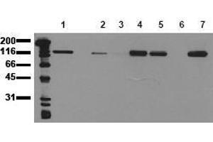 Western Blotting (WB) image for anti-Cadherin 1, Type 1, E-Cadherin (Epithelial) (CDH1) antibody (ABIN126734) (E-cadherin 抗体)
