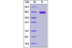 SDS-PAGE (SDS) image for Tumor-Associated Calcium Signal Transducer 2 (TACSTD2) (AA 27-274) protein (Fc Tag) (ABIN7013416)
