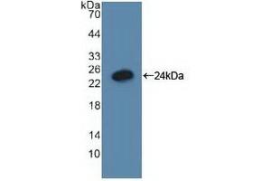 Detection of Recombinant GADD45a, Human using Polyclonal Antibody to Growth Arrest And DNA Damage Inducible Protein Alpha (GADD45a) (GADD45A 抗体  (AA 1-165))