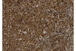 ABIN6278249 at 1/100 staining Mouse spleen tissue by IHC-P. (TRAM2 抗体  (C-Term))