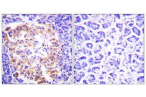 Immunohistochemistry analysis of paraffin-embedded human pancreas tissue, using Collagen Type III antibody. (COL3 抗体  (N-Term))