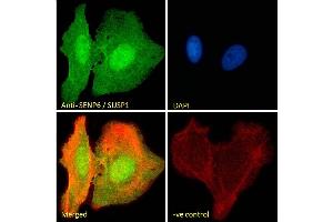 (ABIN334488) Immunofluorescence analysis of paraformaldehyde fixed U2OS cells, permeabilized with 0. (SENP6 抗体  (Internal Region))