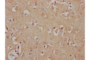 IHC image of nphHU diluted at 1:100 and staining in paraffin-embedded human brain tissue performed on a Leica BondTM system. (MAP3K7 抗体  (AA 179-194))