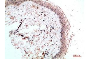 Immunohistochemical analysis of paraffin-embedded human-skin, antibody was diluted at 1:200 (RCC1 抗体  (AA 301-350))
