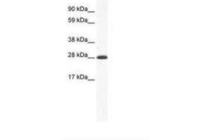 Image no. 1 for anti-Distal-Less Homeobox 4 (DLX4) (AA 57-106) antibody (ABIN202108) (DLX4 抗体  (AA 57-106))