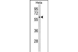 Western blot analysis of CYP7B1 Antibody in Hela cell line lysates (35ug/lane) (CYP7B1 抗体  (AA 252-281))