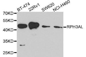 Western blot analysis of extract of various cells, using RPH3AL antibody. (RPH3AL 抗体)