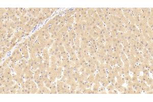 Detection of THRb in Human Liver Tissue using Polyclonal Antibody to Thyroid Hormone Receptor Beta (THRb) (THRB 抗体  (AA 239-457))