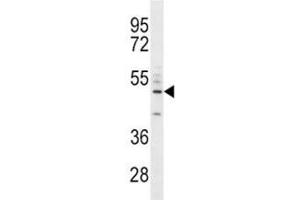 CD14 antibody western blot analysis in A549 lysate. (CD14 抗体  (AA 292-322))