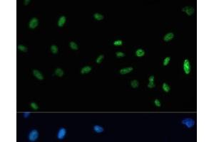 Immunofluorescence analysis of U-2 OS cells using SAFB Polyclonal Antibody at dilution of 1:100. (SAFB 抗体)