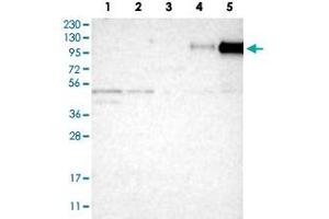Western Blot analysis of Lane 1: RT-4 cell, Lane 2: U-251 MG sp cell, Lane 3: human plasma tissue (IgG/HSA depleted), Lane 4: human liver tissue and Lane 5: human tonsil tissue lysates with ITGB2 polyclonal antibody .