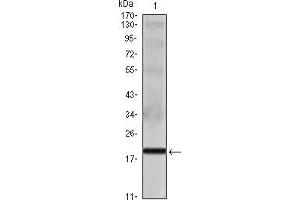 Western blot analysis using IL16 mouse mAb against IL16 recombinant protein. (IL16 抗体)