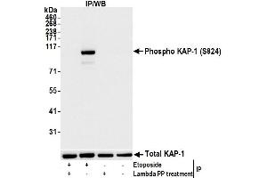 Immunoprecipitation (IP) image for anti-Tripartite Motif Containing 28 (TRIM28) (pSer824) antibody (ABIN7450388)