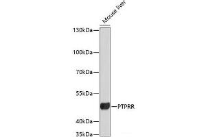 Western blot analysis of extracts of Mouse liver using PTPRR Polyclonal Antibody at dilution of 1:3000. (PTPRR 抗体)