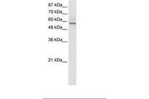 Image no. 1 for anti-Transmembrane Protein 175 (TMEM175) (AA 34-83) antibody (ABIN202675) (TMEM175 抗体  (AA 34-83))