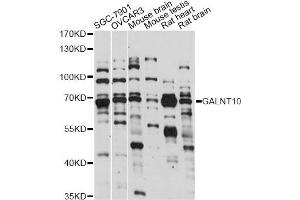 Western blot analysis of extracts of various cell lines, using GALNT10 antibody (ABIN6293992) at 1:1000 dilution. (GALNT10 抗体)