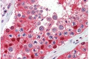 Testis, Human: Formalin-Fixed, Paraffin-Embedded (FFPE) (Ubiquitin 抗体)