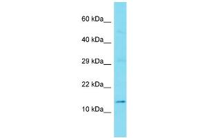 Western Blotting (WB) image for anti-Gilles De La Tourette Syndrome Chromosome Region, Candidate 1 (GTSCR1) (N-Term) antibody (ABIN2791569) (GTSCR1 抗体  (N-Term))