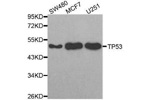 Western blot analysis of extracts of various cell lines, using TP53 antibody. (p53 抗体)