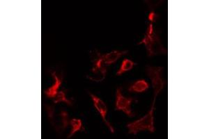 ABIN6274450 staining COLO205 cells by IF/ICC. (MADD 抗体  (Internal Region))