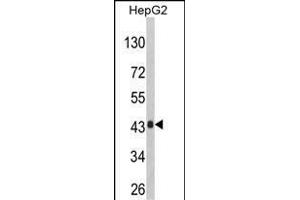 Western Blotting (WB) image for anti-Alanine Glyoxylate Aminotransferase (AGXT) (AA 96-125) antibody (ABIN390393)