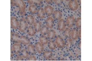 Detection of b2M in Mouse Kidney Tissue using Monoclonal Antibody to Beta-2-Microglobulin (b2M) (beta-2 Microglobulin 抗体  (AA 22-119))