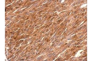 IHC-P Image PGCP antibody detects PGCP protein at cytosol on U373 xenograft by immunohistochemical analysis. (CPQ 抗体)