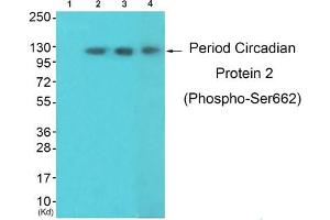 Western blot analysis of extracts from 3T3lbnotHeLa and K562 cells, using Period Circadian Protein 2 (Phospho-Ser662) Antibody. (PER2 抗体  (pSer662))