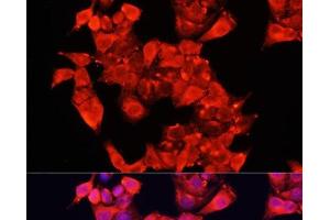 Immunofluorescence analysis of HeLa cells using AOC1 Polyclonal Antibody at dilution of 1:100 (40x lens). (DAO 抗体)