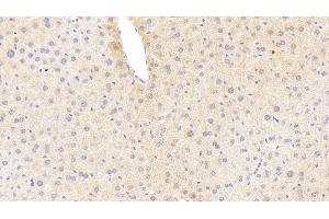 Detection of TREM1 in Mouse Liver Tissue using Polyclonal Antibody to Triggering Receptor Expressed On Myeloid Cells 1 (TREM1) (TREM1 抗体  (AA 21-230))
