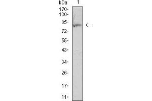 Western Blotting (WB) image for anti-Integrin beta 2 (ITGB2) (AA 559-700) antibody (ABIN7193283)