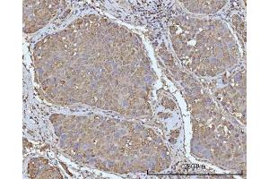 IHC analysis of OCRL using anti-OCRL antibody (ABIN7599572).