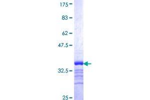 SLC18A3 Protein (AA 476-532) (GST tag)