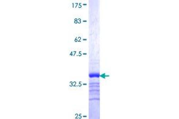 SLC18A3 Protein (AA 476-532) (GST tag)