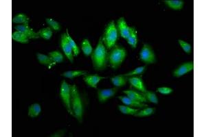 Immunofluorescence staining of Hela cells with ABIN7154344 at 1:66, counter-stained with DAPI. (PIGV 抗体  (AA 400-469))